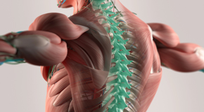 Millville thoracic spine